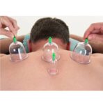 دستة كاسات الـ حجامة النبوية درجة اولى 12 طاسة ، 5 احجام لجميع انحاء الجسد والوجه