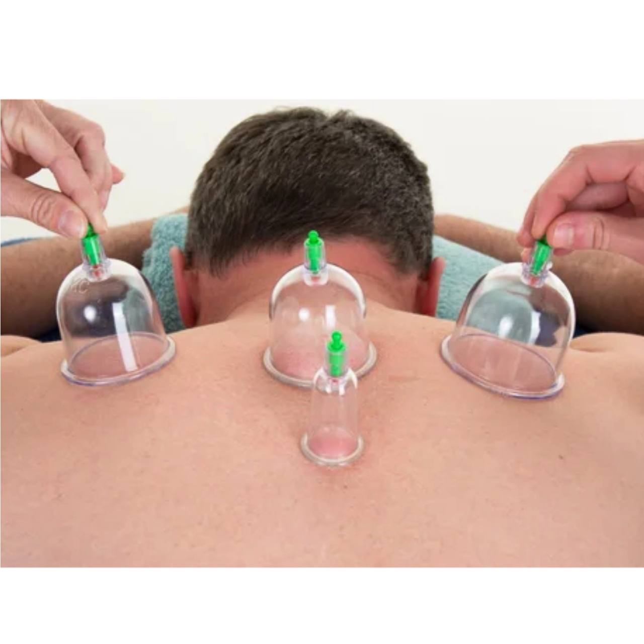 photo_1_2025-08-27_14-19-24 دستة كاسات الـ حجامة النبوية درجة اولى 12 طاسة ، 5 احجام لجميع انحاء الجسد والوجه - الصورة 1